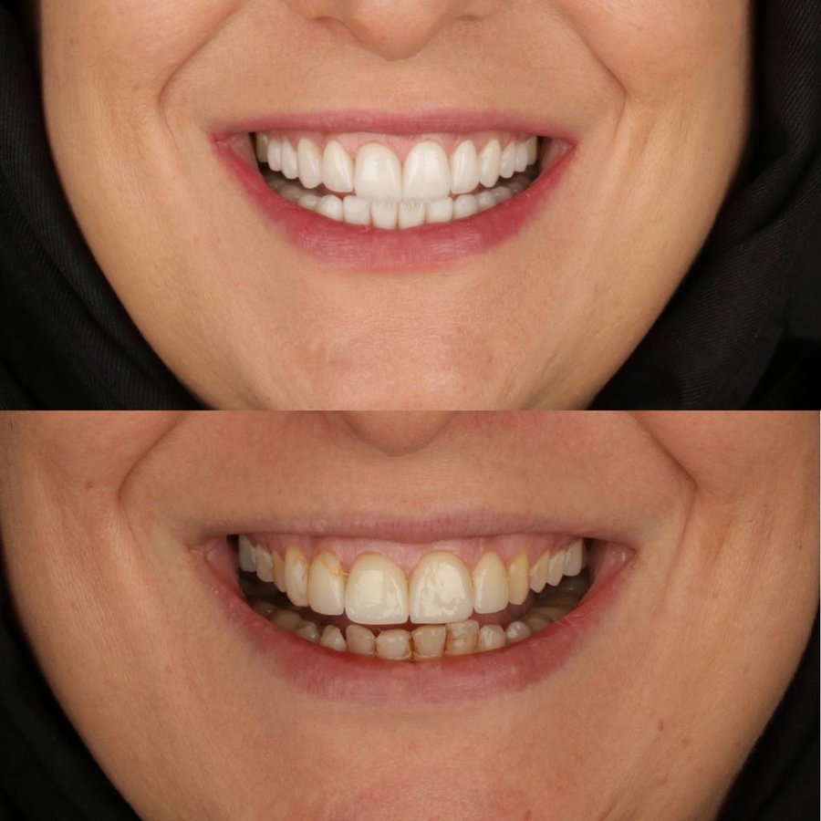 فكرة عيادة الأسنان - idea dental clinic