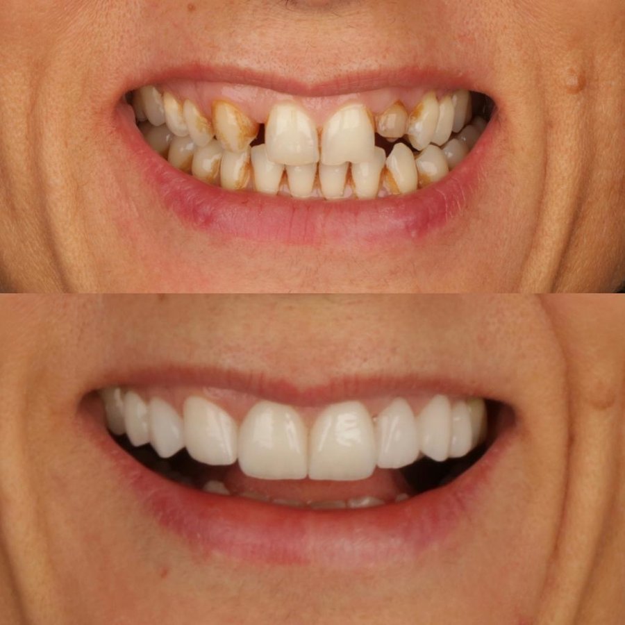 فكرة عيادة الأسنان - idea dental clinic