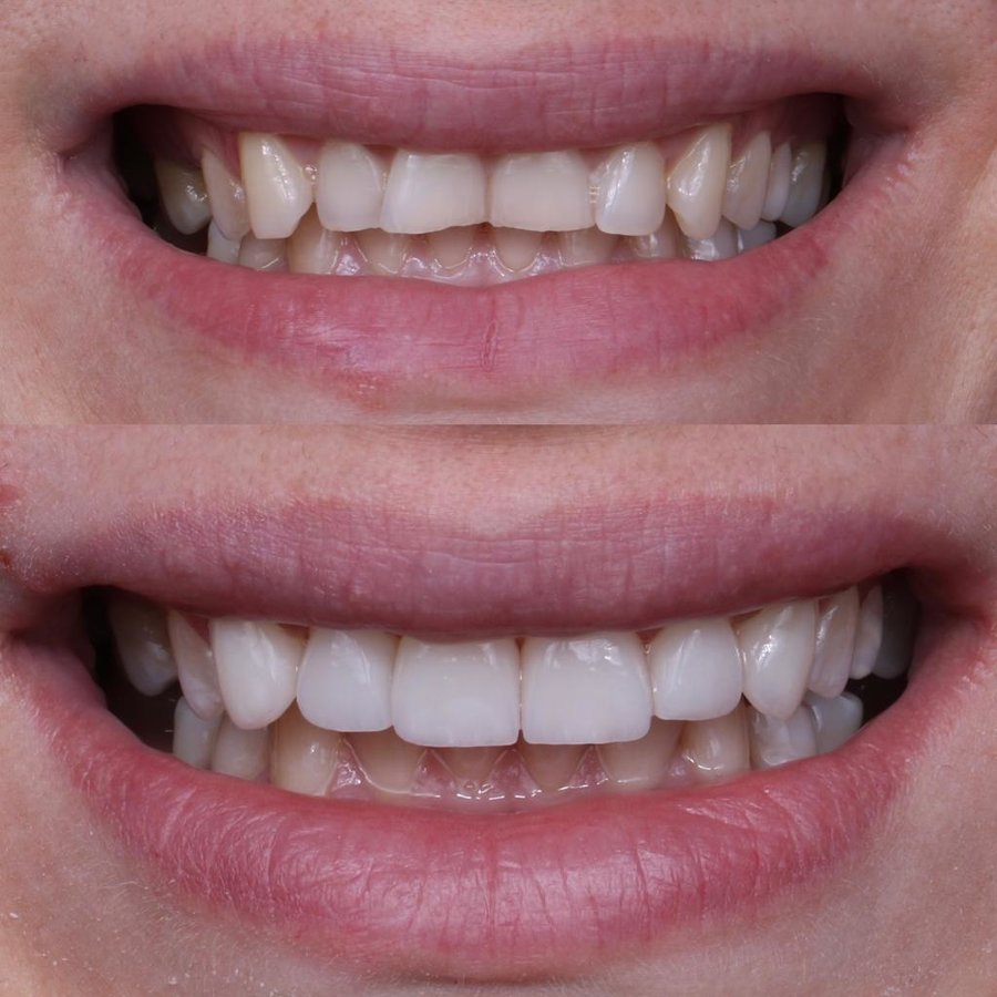 فكرة عيادة الأسنان - idea dental clinic