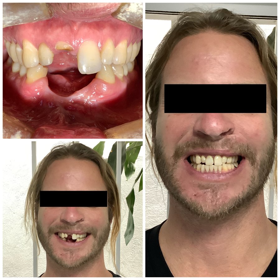 Ideal Dental Center - Merida - Ideal Dental Center - Merida