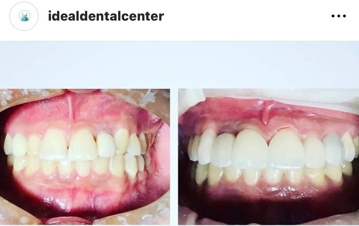 Ideal Dental Center - Merida - Ideal Dental Center - Merida