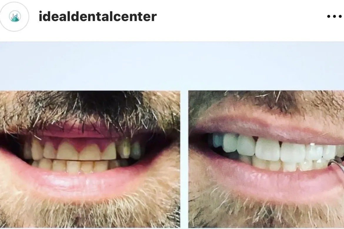 Ideal Dental Center - Merida - Ideal Dental Center - Merida