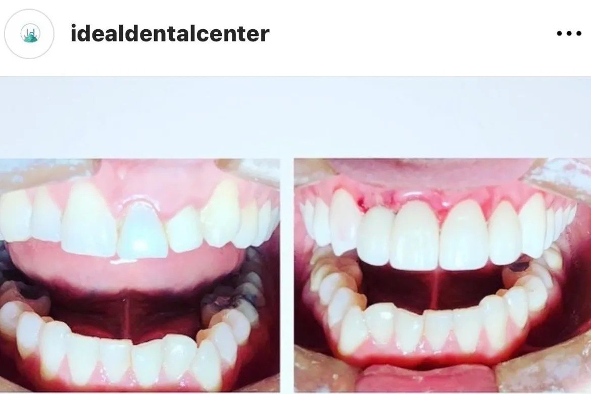 Ideal Dental Center - Merida - Ideal Dental Center - Merida