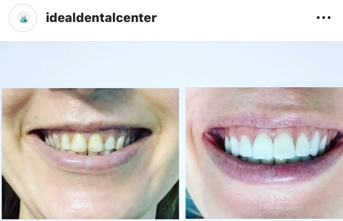 Ideal Dental Center - Merida - Ideal Dental Center - Merida