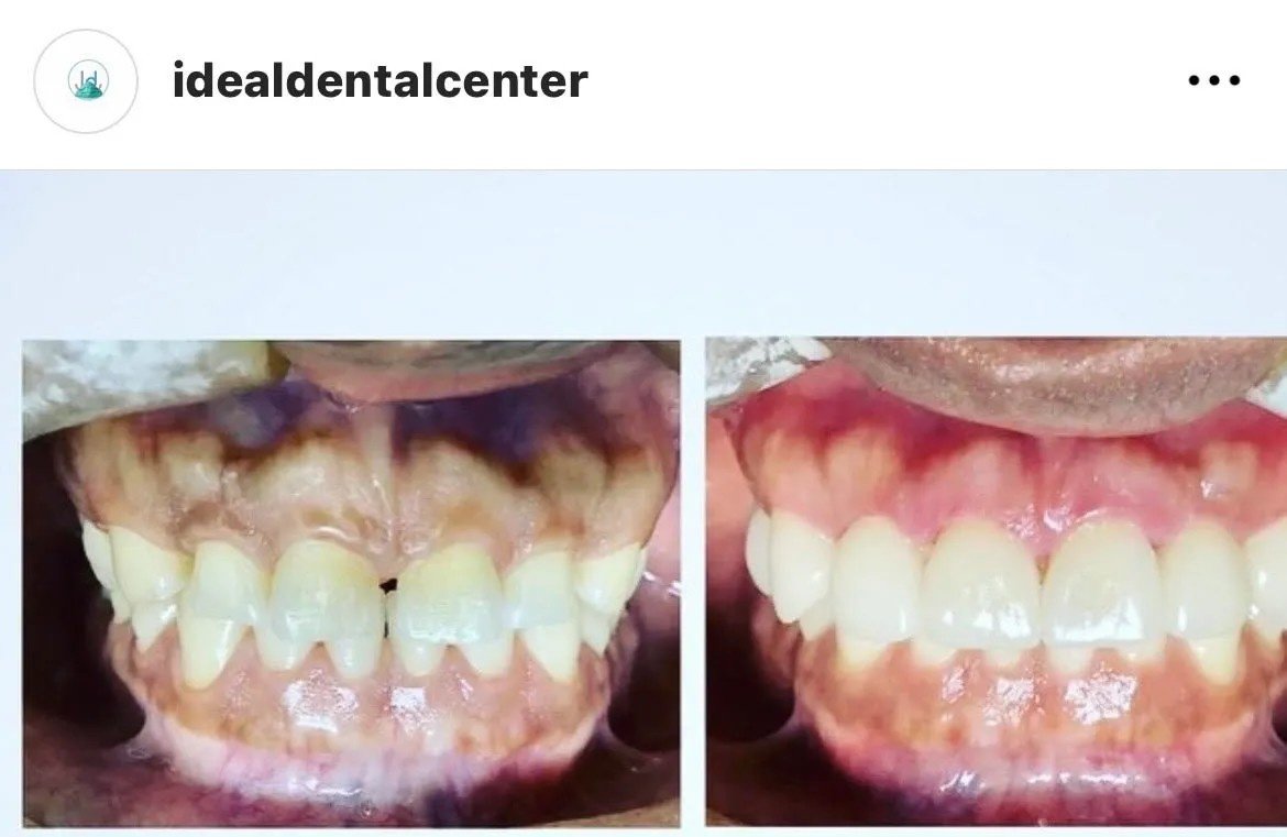 Ideal Dental Center - Merida - Ideal Dental Center - Merida