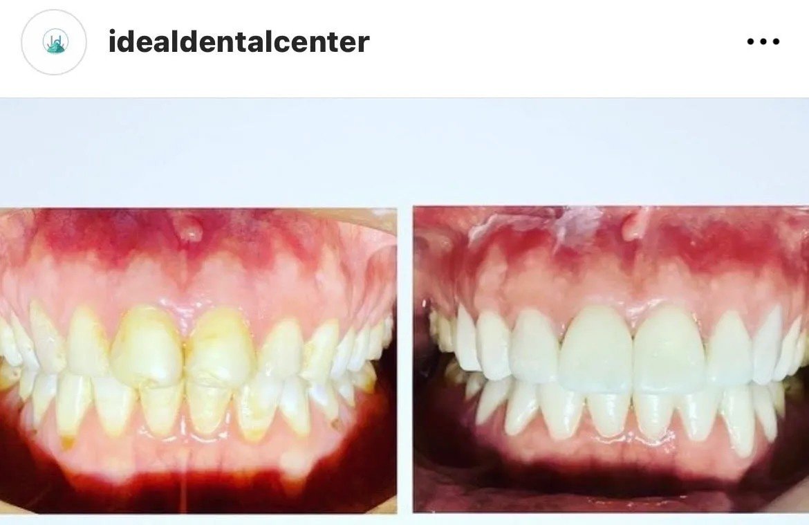 Ideal Dental Center - Merida - Ideal Dental Center - Merida