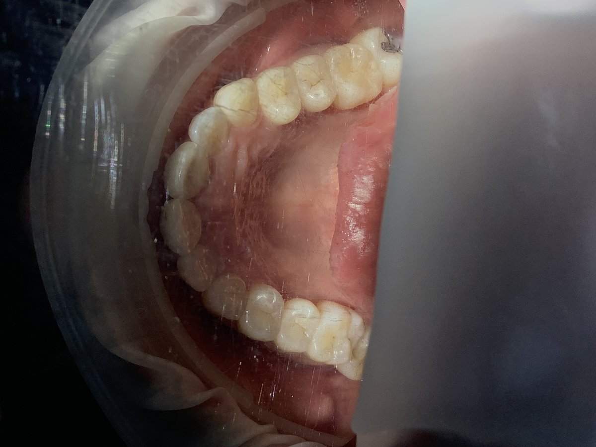 Ideal Dental Center - Merida - Ideal Dental Center - Merida