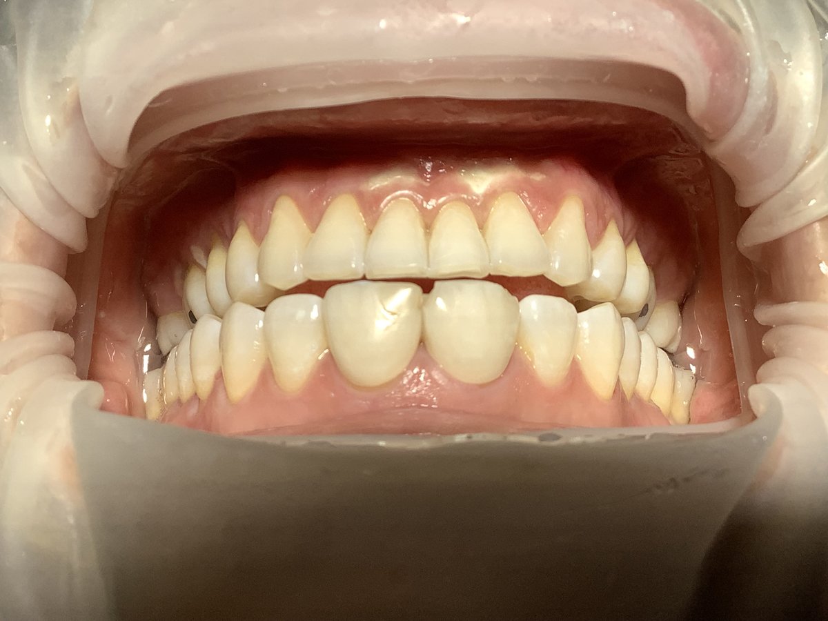 Ideal Dental Center - Merida - Ideal Dental Center - Merida