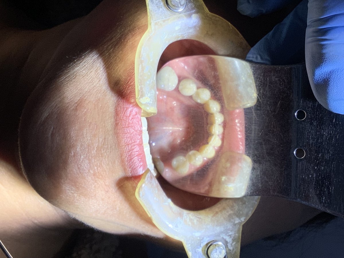 Ideal Dental Center - Merida - Ideal Dental Center - Merida