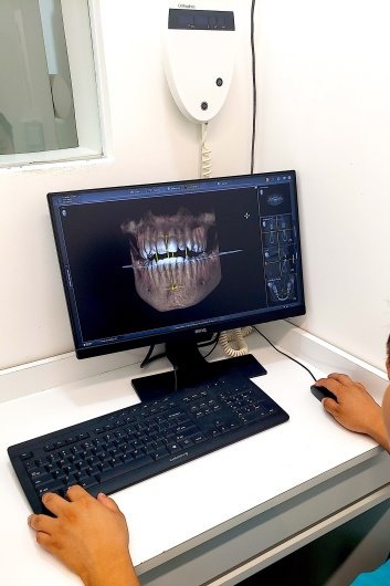 Ideal Dental Center - Merida - Ideal Dental Center - Merida