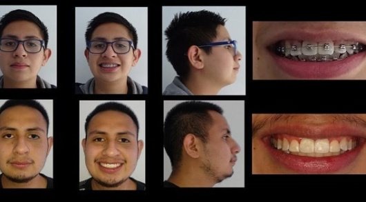 Ideal Dental Center - Merida - Ideal Dental Center - Merida