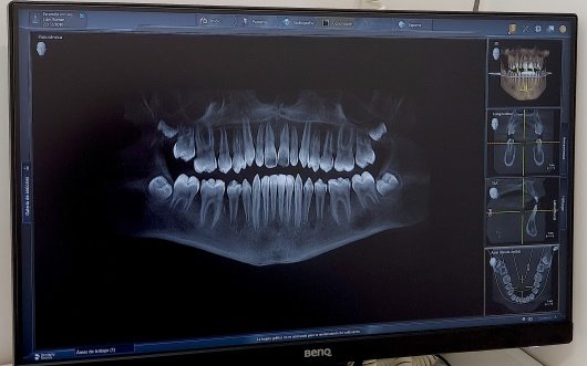 Ideal Dental Center - Merida - Ideal Dental Center - Merida