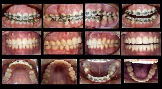 Ideal Dental Center - Merida - Ideal Dental Center - Merida