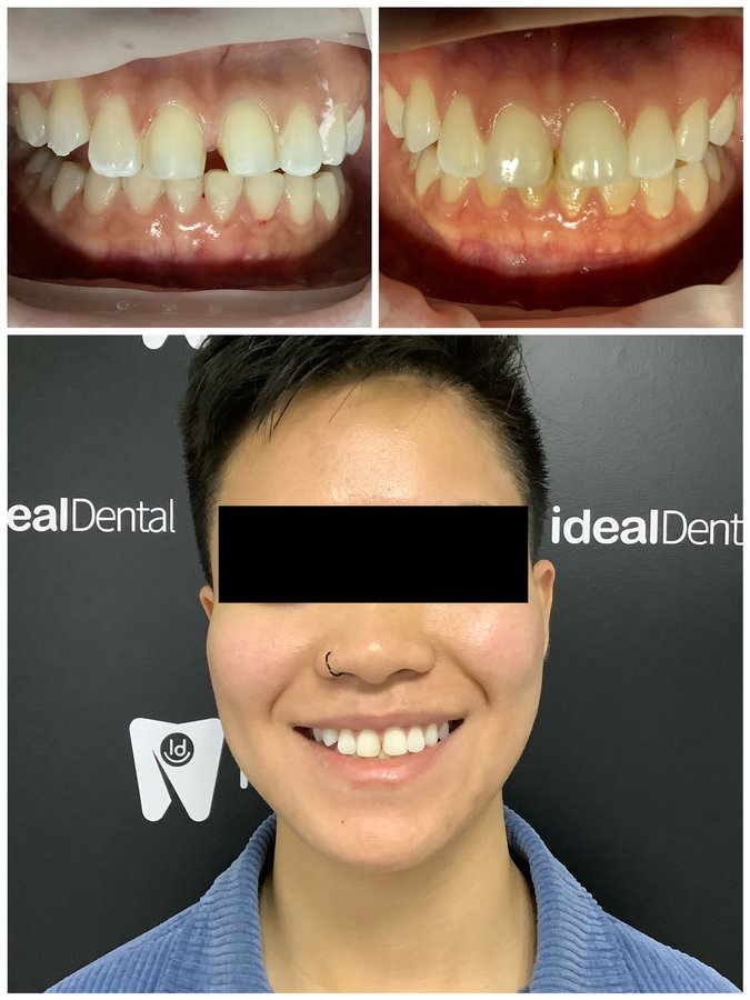 Ideal Dental Center - Merida - Ideal Dental Center - Merida