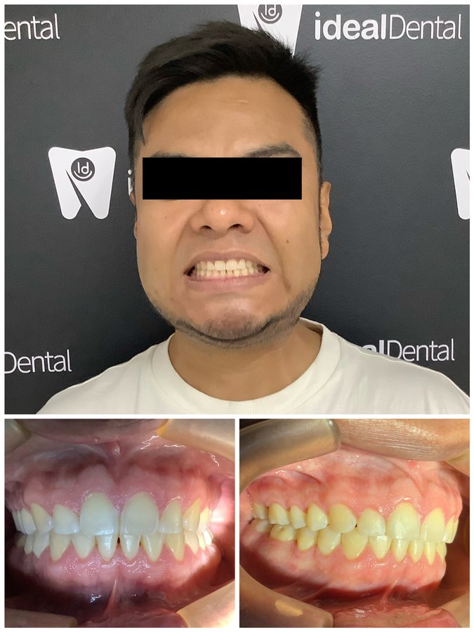 Ideal Dental Center - Merida - Ideal Dental Center - Merida