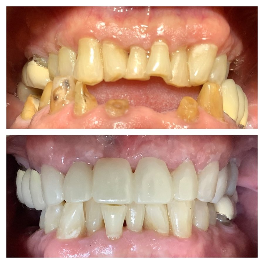 Ideal Dental Center - Merida - Ideal Dental Center - Merida