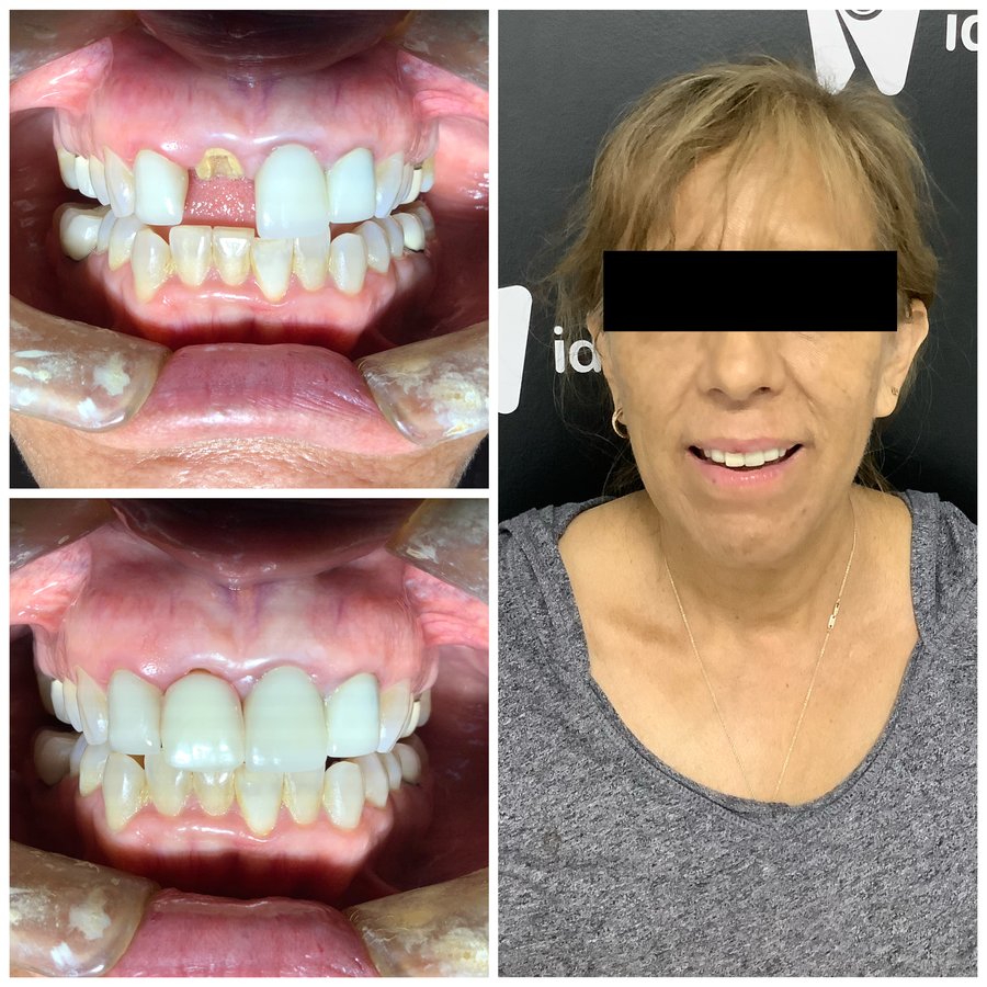 Ideal Dental Center - Merida - Ideal Dental Center - Merida