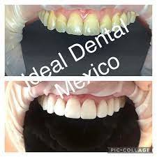 Ideal Dental Center - Mexico City - Ideal Dental Center - Mexico City