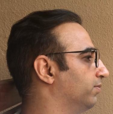 iGraft Global Hyderabad - iGraft Global Hyderabad