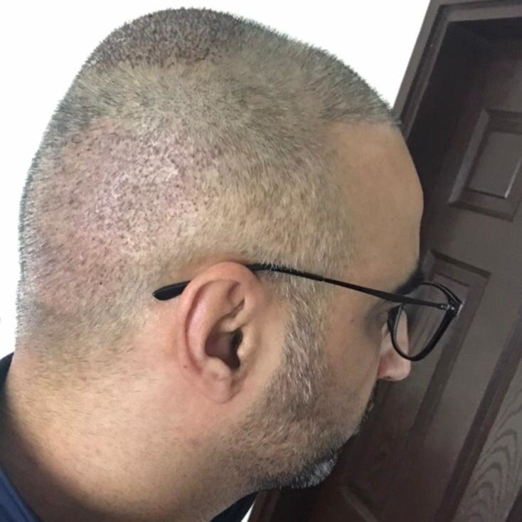 iGraft Global Hyderabad - iGraft Global Hyderabad