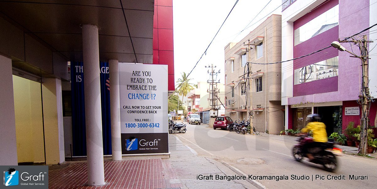 iGraft Hyderabad - iGraft Hyderabad