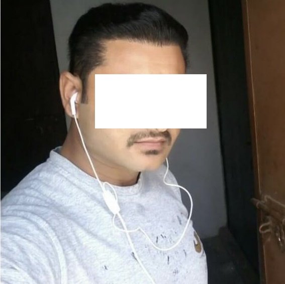 iGraft Hyderabad - iGraft Hyderabad