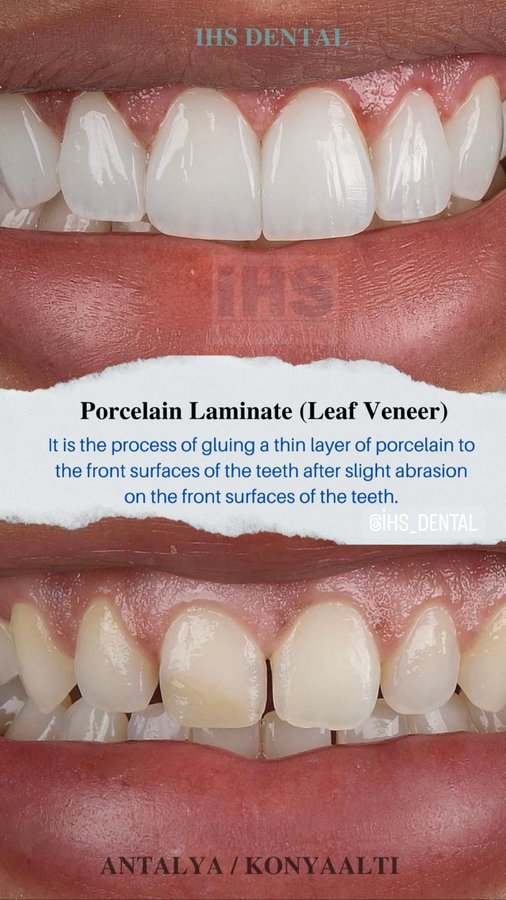 IHS Medical - IHS Medical