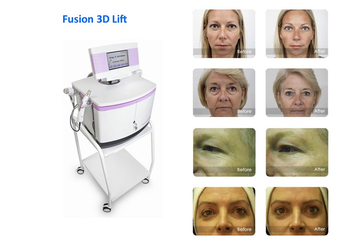 مركز لازر I-Lipo - I-Lipo Lazer Centre