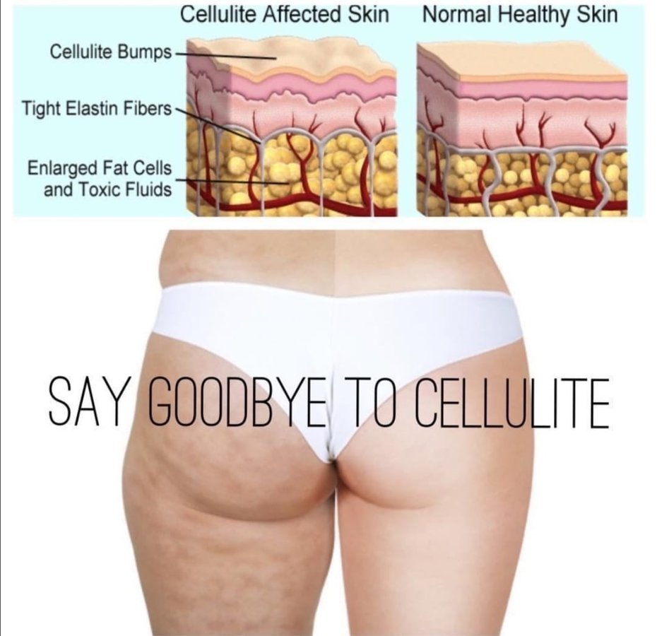 مركز لازر I-Lipo - I-Lipo Lazer Centre