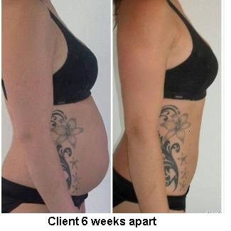 مركز لازر I-Lipo - I-Lipo Lazer Centre