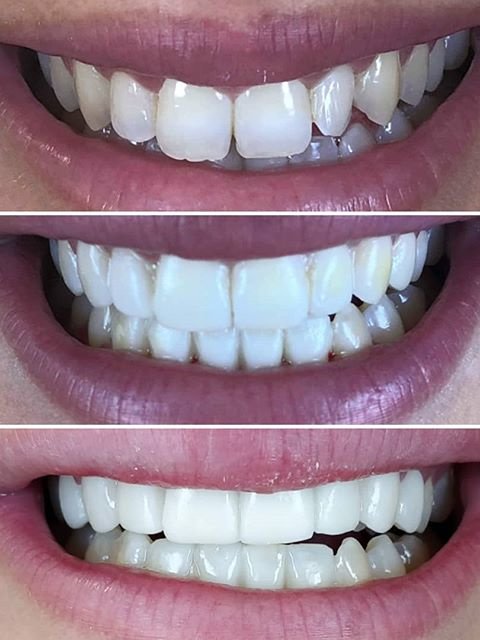 Illumidental - Illumidental