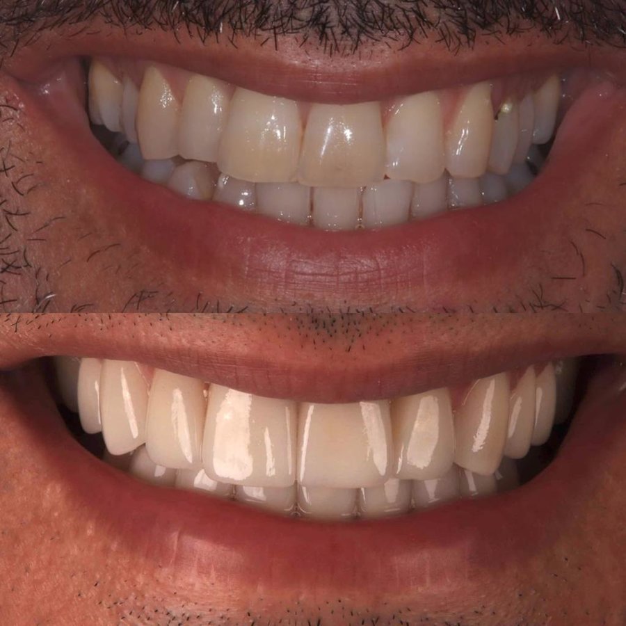 Illumidental - Illumidental