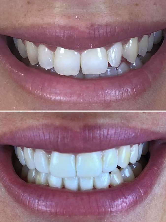 Illumidental - Illumidental