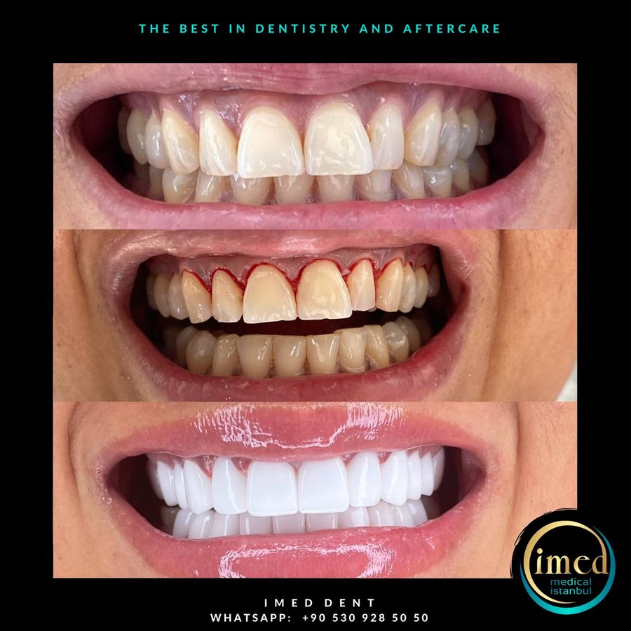 iMed Dent - iMed Dent