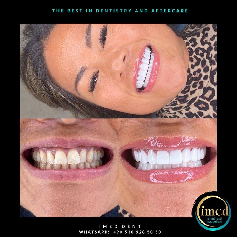 iMed Dent - iMed Dent