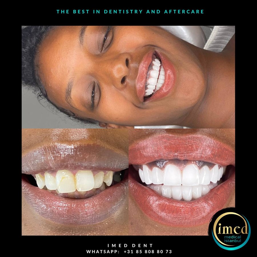 iMed Dent - iMed Dent