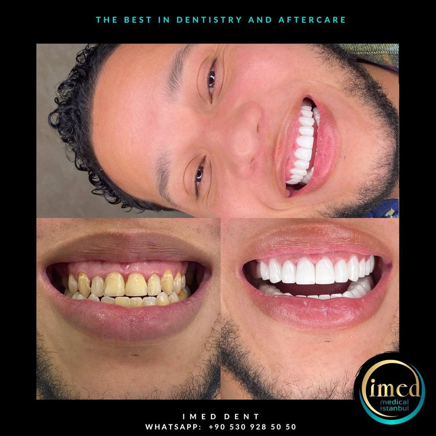 iMed Dent - iMed Dent