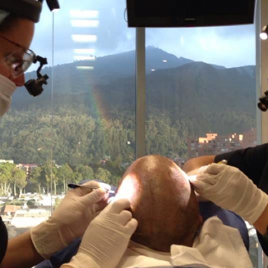 Implante de Pelo - Implante de Pelo