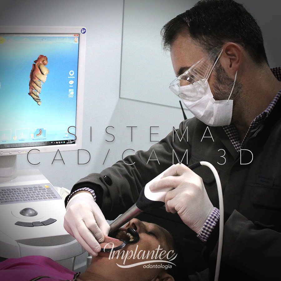 إمبلانتيك أودونتولوجيا - Implantec Odontologia