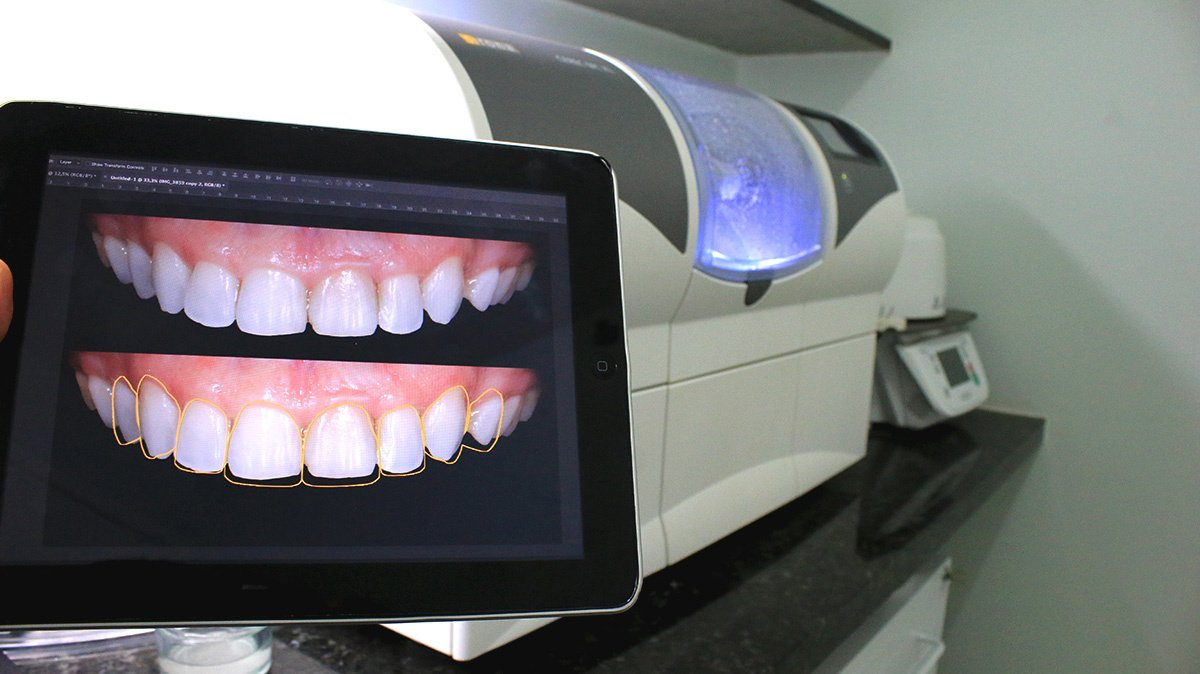 إمبلانتيك أودونتولوجيا - Implantec Odontologia