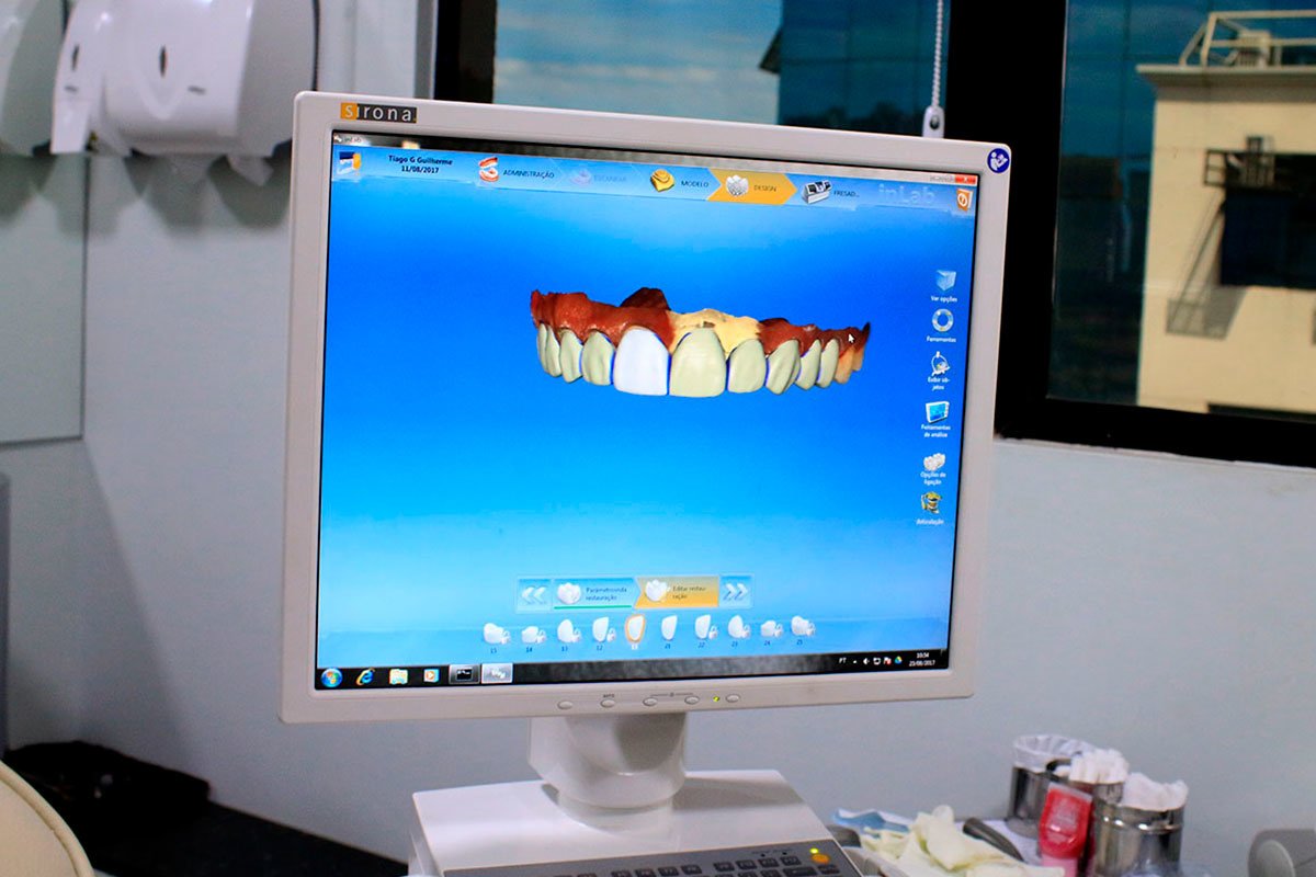 إمبلانتيك أودونتولوجيا - Implantec Odontologia