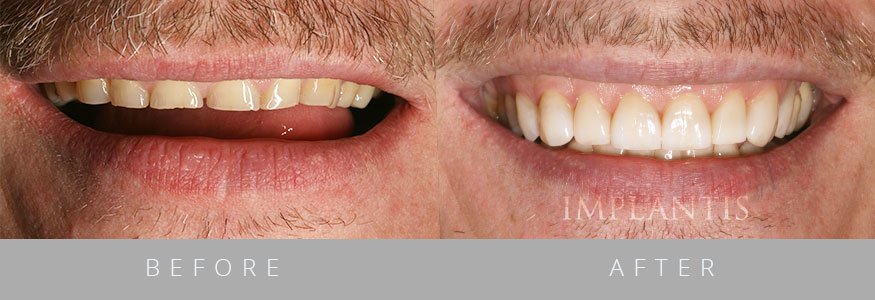 Implantis Dental Clinic - Implantis Dental Clinic