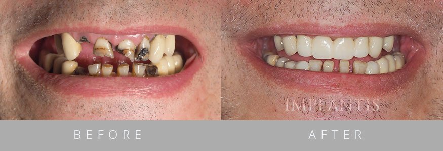 Implantis Dental Clinic - Implantis Dental Clinic