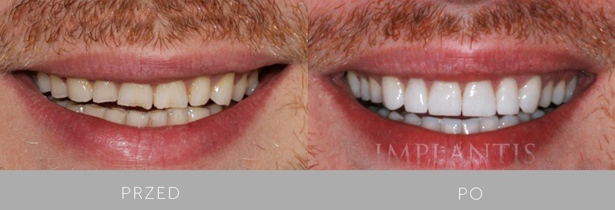 Implantis Dental Clinic - Implantis Dental Clinic