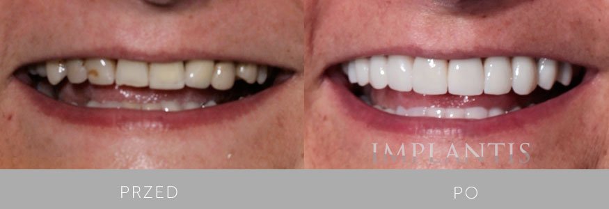 Implantis Dental Clinic - Implantis Dental Clinic