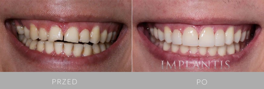 Implantis Dental Clinic - Implantis Dental Clinic