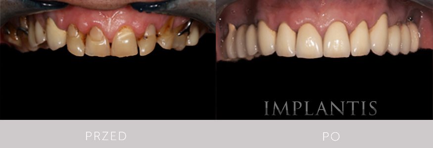 Implantis Dental Clinic - Implantis Dental Clinic