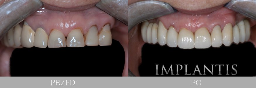 Implantis Dental Clinic - Implantis Dental Clinic