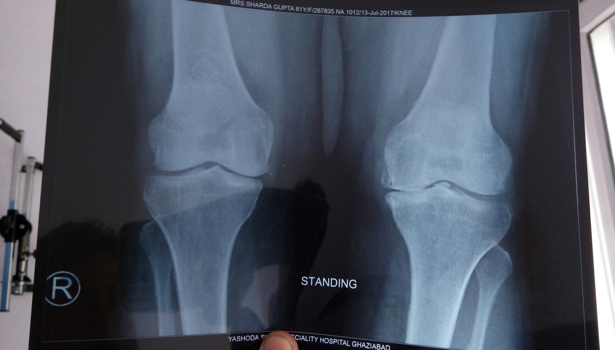 Indian Spine & Pain Care Center - Indian Spine & Pain Care Center