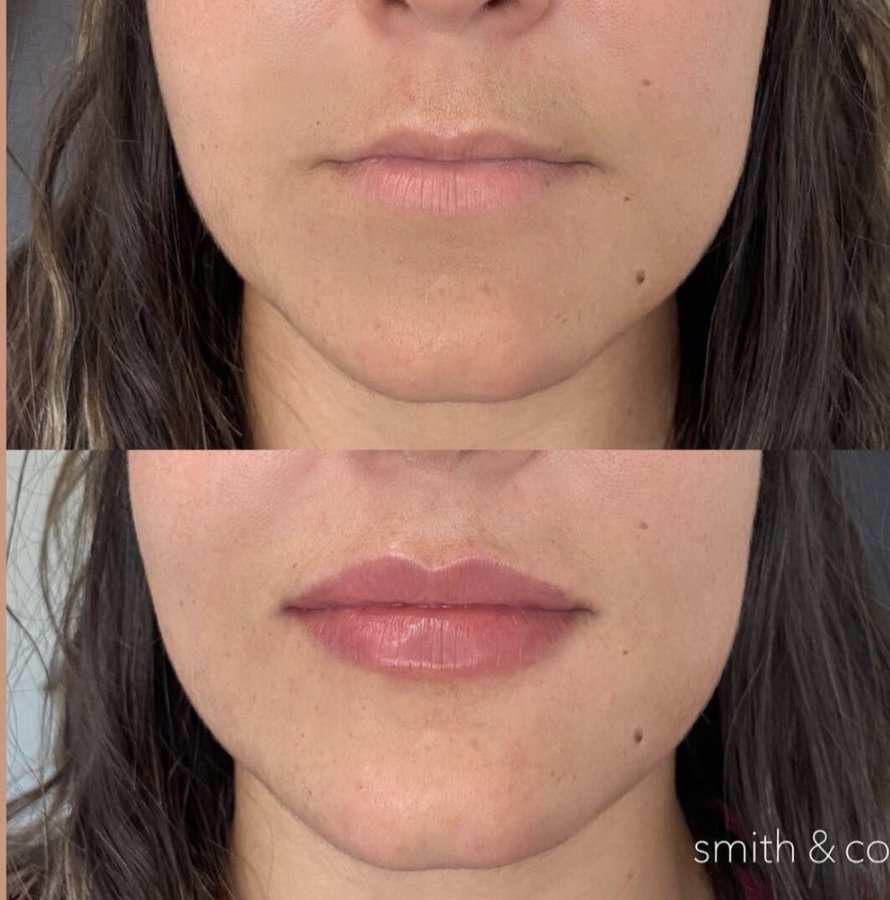 Infinity Aesthetics - Infinity Aesthetics